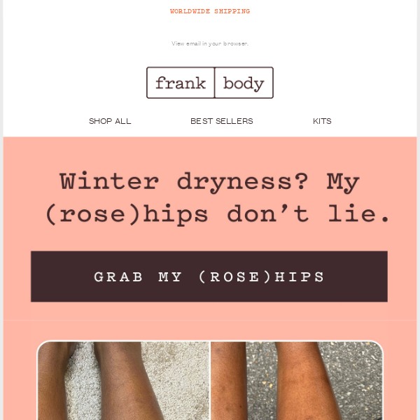 Have you fallen victim to winter dryness?
