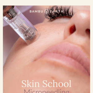 Skin School: Microneedling