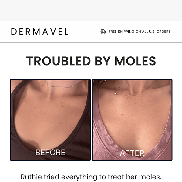 She had a mole problem…