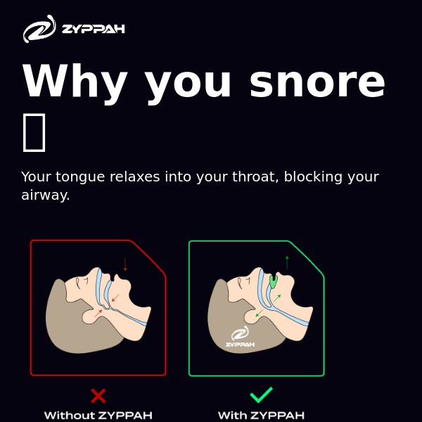 CLINICALLY PROVEN: WHY YOU SNORE