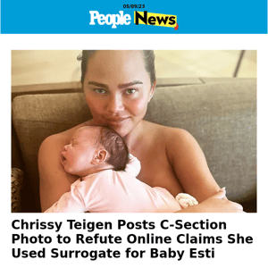 Chrissy Teigen posts c-section photo to refute online claims she used surrogate for baby Esti