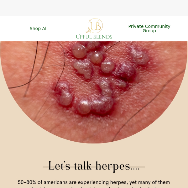 This is what herpes really is! 👉