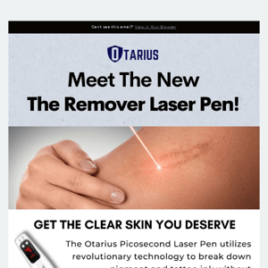 ❗ Introducing the Remover Laser Pen