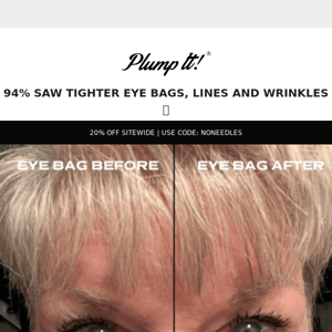 94% saw tighter eye bags & fine lines 😍➡️
