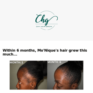 👀 6 Month's Hair Growth Result!