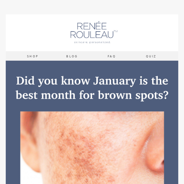 Say "Goodbye" to Brown Spots 👋