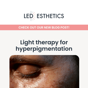 Light therapy for hyperpigmentation