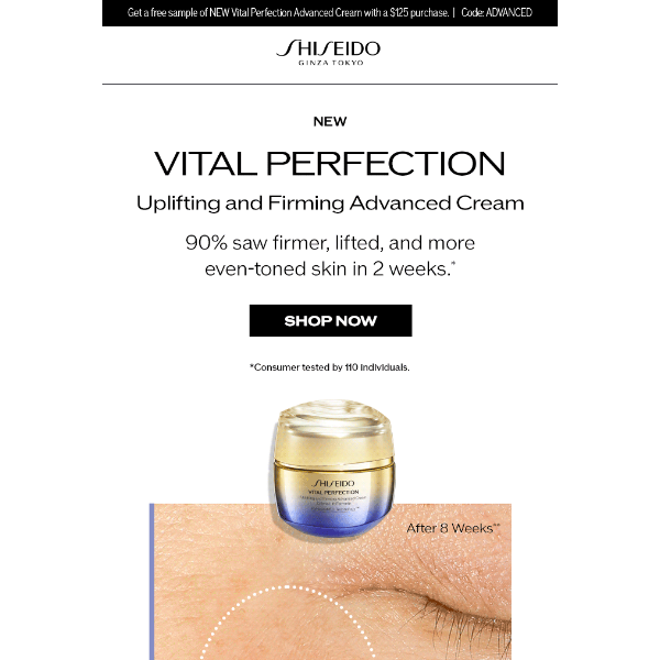 NEW Vital Perfection Advanced Cream: Before & After