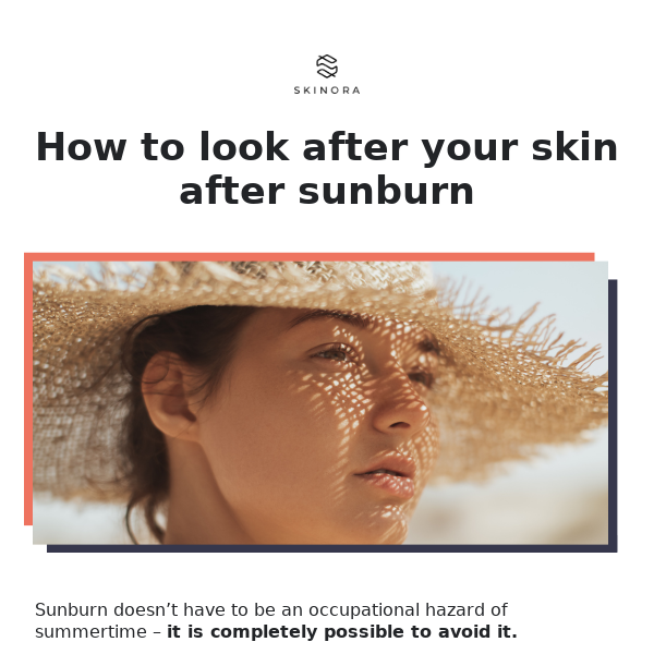 Sunburn Skin: How to look after it?