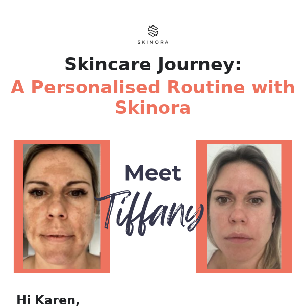 Skincare Journey: A Personalised Routine with Skinora
