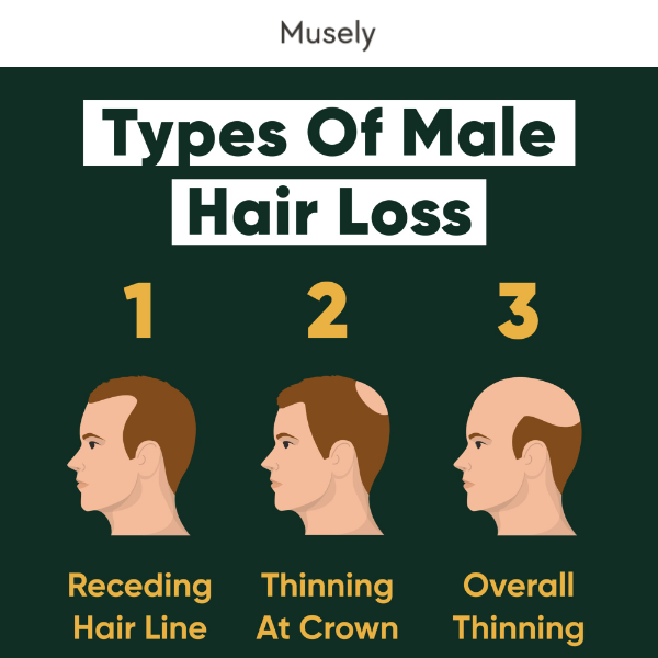Just Treat it! Your Guide To Treating Hair Loss ✅