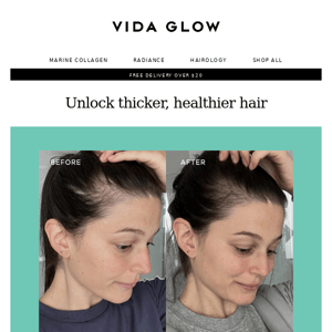 Vida Glow are you ready for thicker, healthier hair?