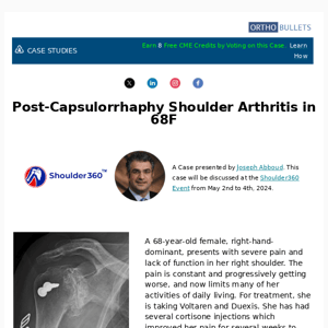 New Case: Post-Capsulorrhaphy Shoulder Arthritis in 68F