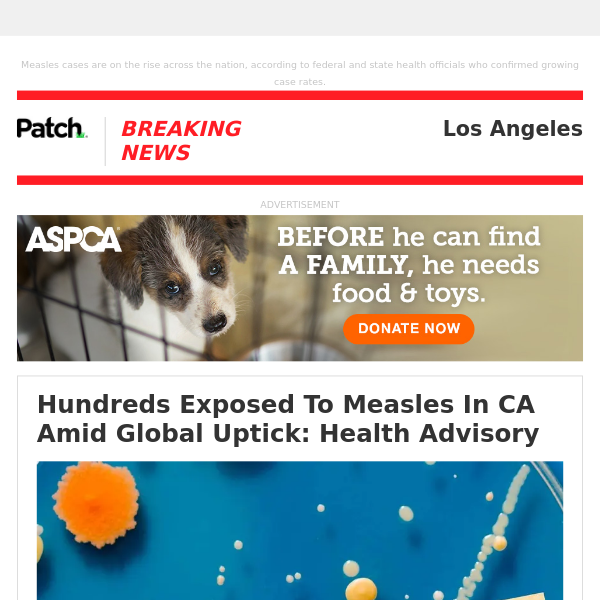 ALERT: Hundreds Exposed To Measles In CA Amid Global Uptick: Health Advisory – Wed 11:35:12AM