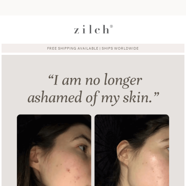 “I'm no longer ashamed of my skin.”