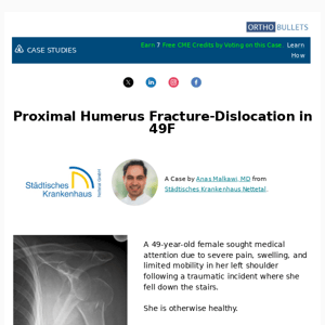 New Case: Proximal Humerus Fracture-Dislocation in 49F