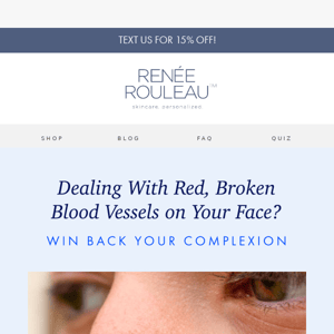 7 hacks to help with broken blood vessels ✨