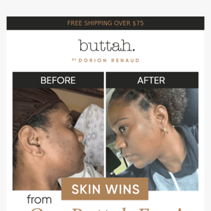 Shocking Skin Transformation
