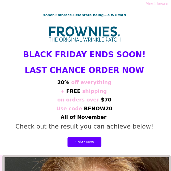 LAST CHANCE 20% FROWNIES for NOVEMBER