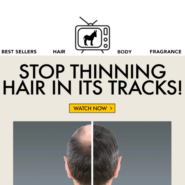 STOP Thinning Hair In Its Tracks!