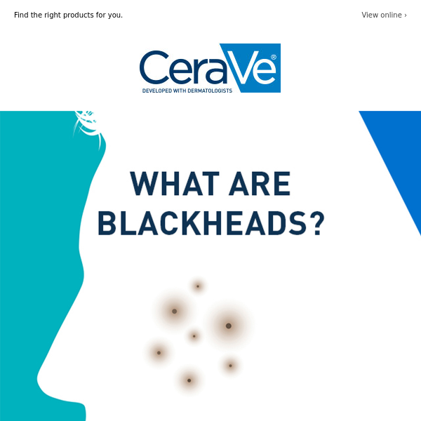 What Are Blackheads?