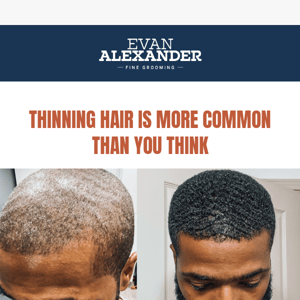 Success Story: Reverse & Stop Thinning Hair