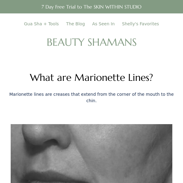 Get Rid of Marionette Lines