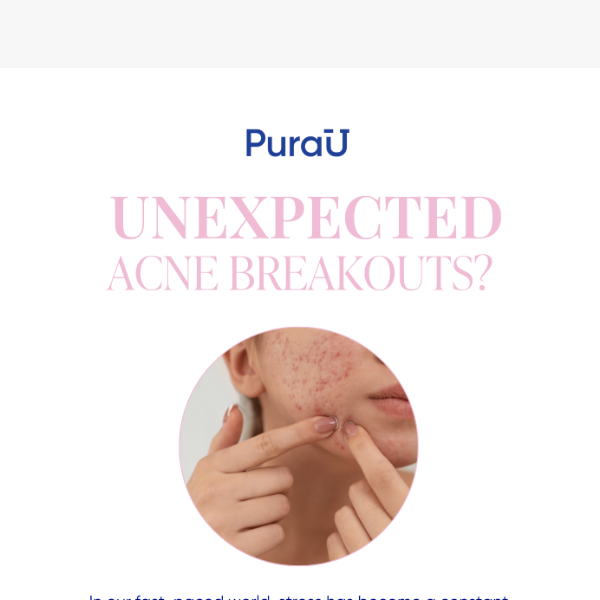 Breakouts Making You Stressed?