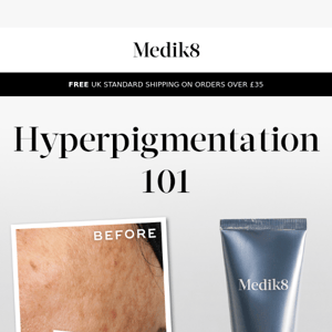 Hyperpigmentation 101