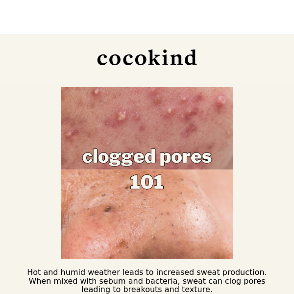 humid weather = clogged pores - Cocokind