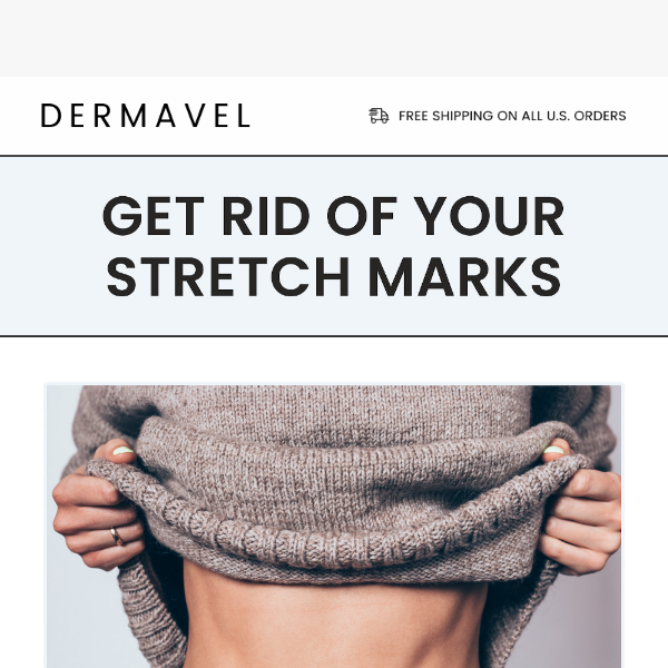 Say Goodbye to Stretch Marks