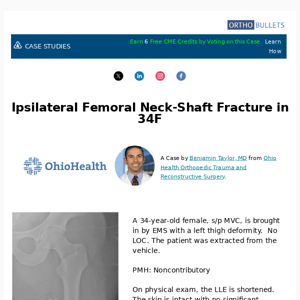 New Case: Ipsilateral Femoral Neck-Shaft Fracture in 34F