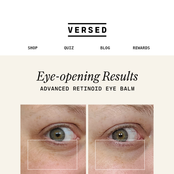 Brighter, smoother undereyes