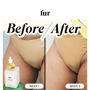 Before & After with Ingrown Concentrate