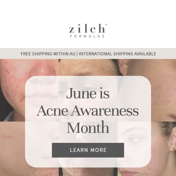 Acne Awareness Month.