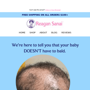 Baby Balding.... Let's Talk About It 👶 🍼