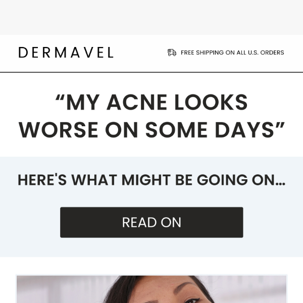 Why acne scars appear worse some days