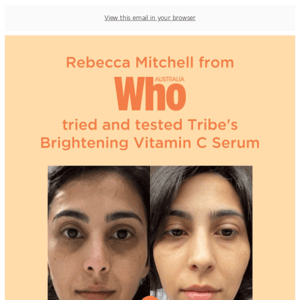 "After a few uses, I did find my skin looking brighter..." - Rebecca Mitchell