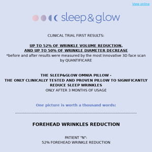 Clinical trial results👩‍⚕️ Up to 52% of sleep wrinkles volume reduction only after 3 months of usage the Omnia pillow