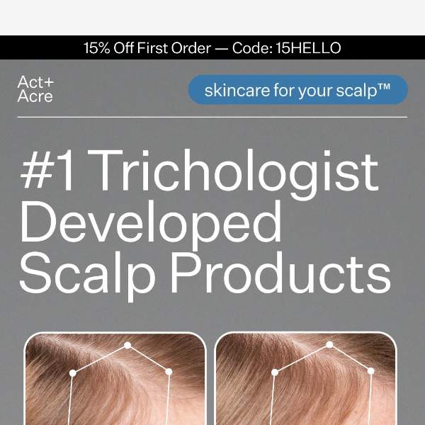 #1 Trichologist Developed Scalp Products