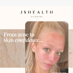 “It’s changed my life and my skin!”