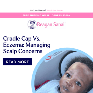 Cradle Cap or Eczema? 🤔 Know the Differences