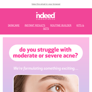 Got Acne?