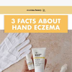 Hand eczema? Not on our watch!