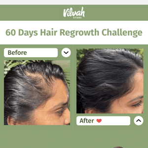 20% OFF on this Hair Affair 🫶🏽 Hair Growth oil