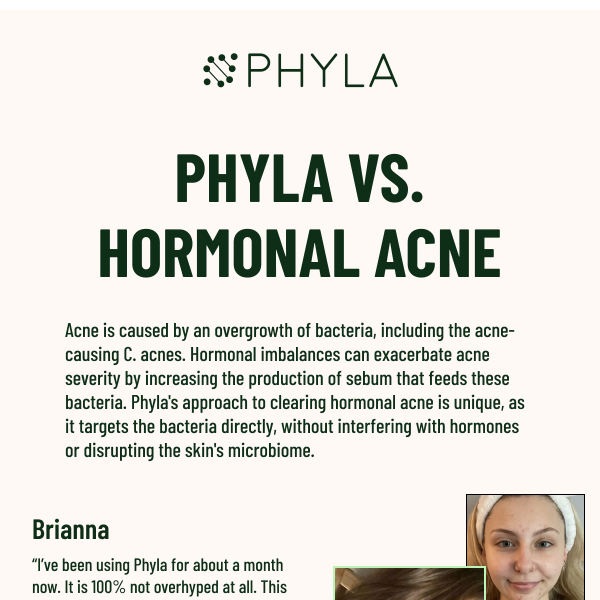 Suffering from hormonal acne?