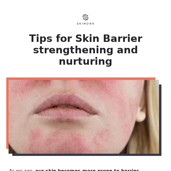 Tips for Skin Barrier strengthening and nurturing