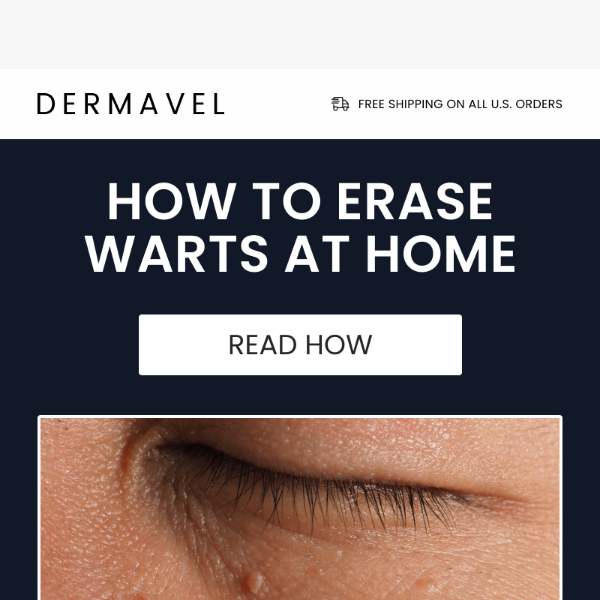 Can warts fall off naturally?