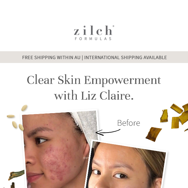 Liz Claire’s skin transformation.