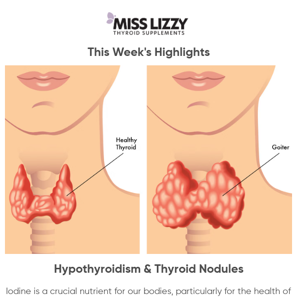 Hypothyroidism & Thyroid Nodules